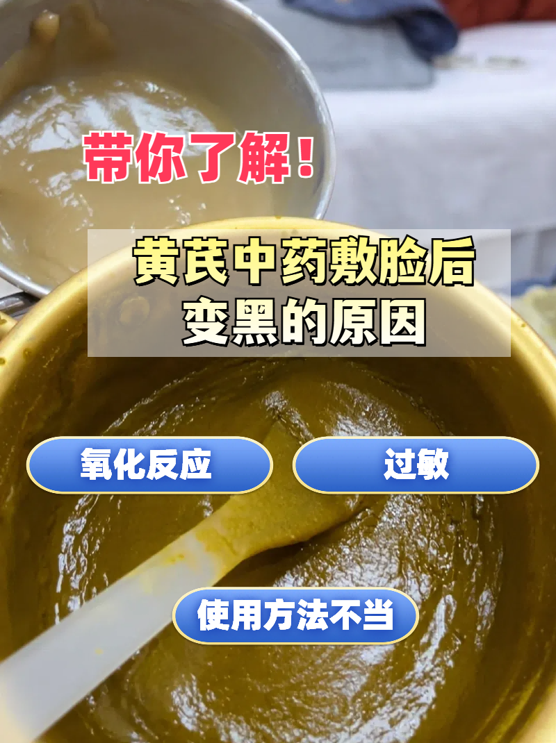 谁有中药敷脸祛痘的药方